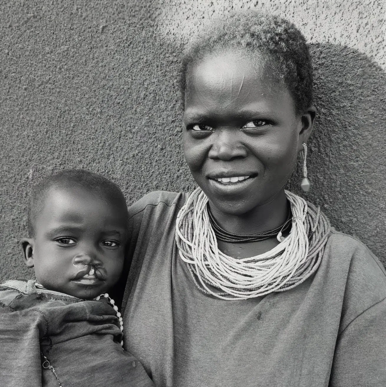 Upasuaji International community health work in East Africa